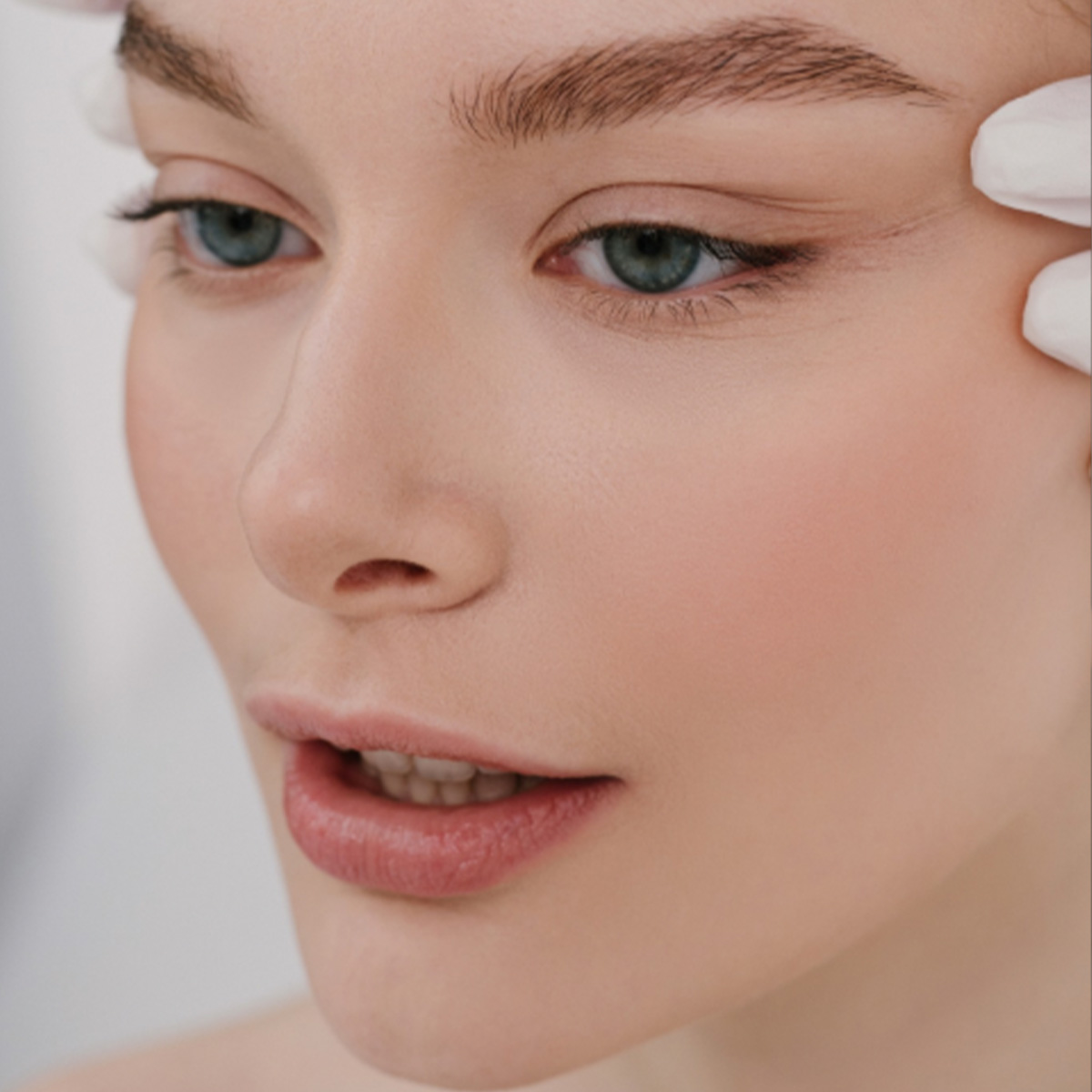 RF Microneedling in Dubai