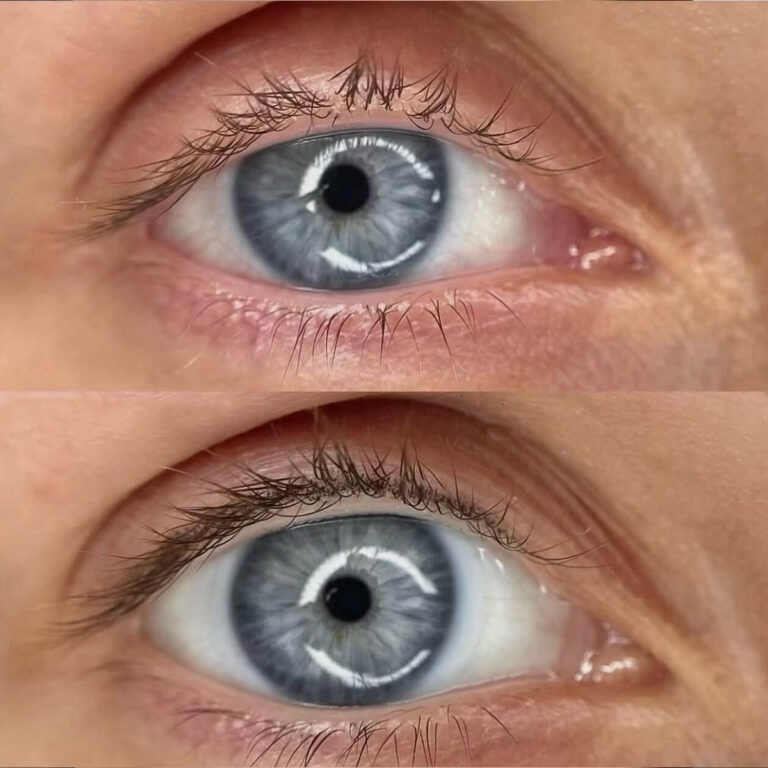 Permanent Lashline Enhancement