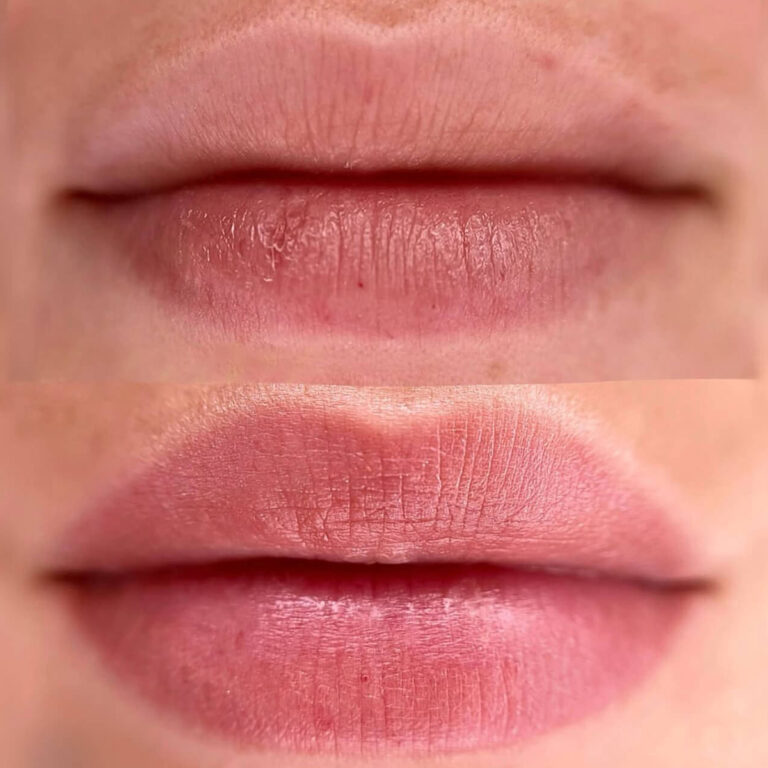 Permanent Lips Makeup